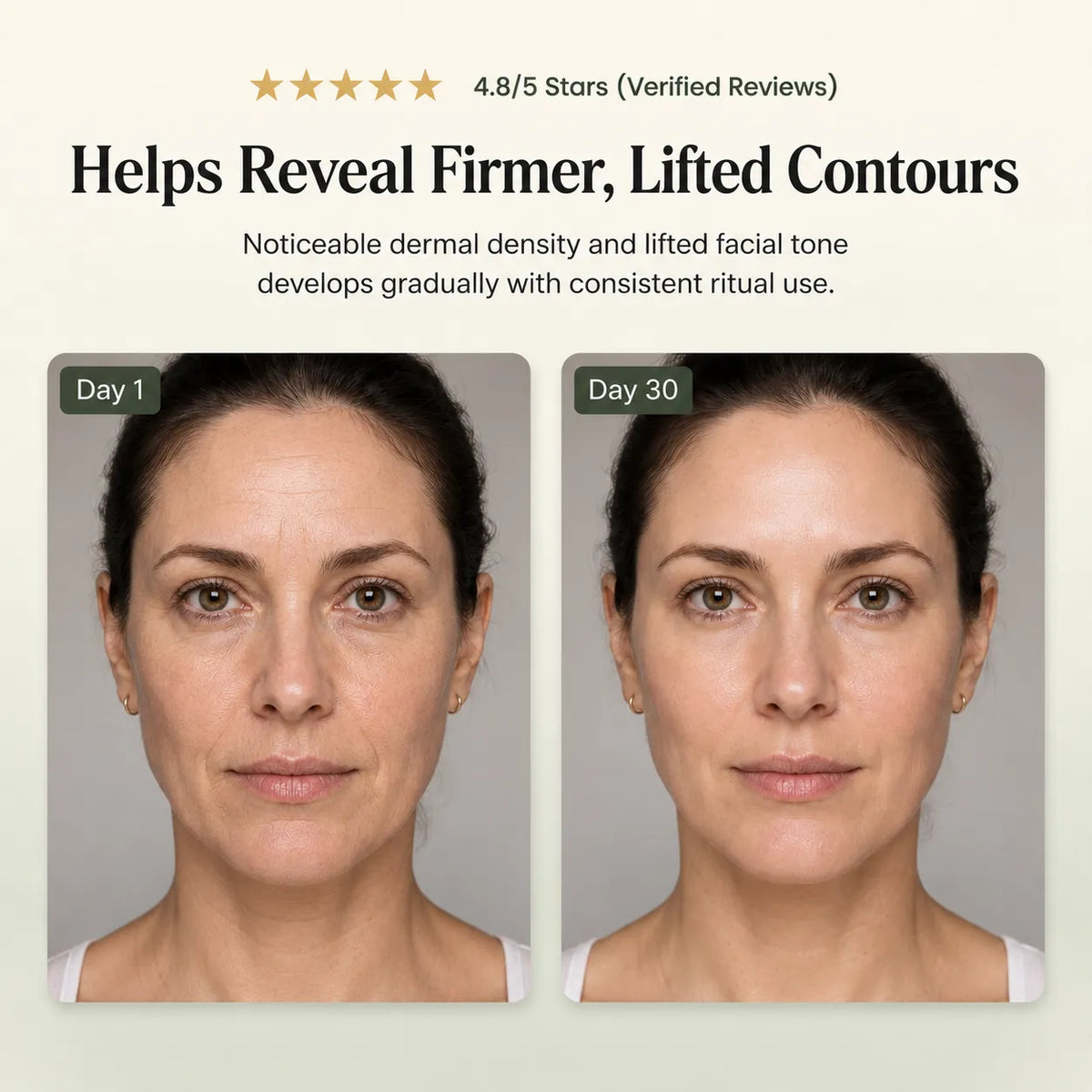 LEVATIQUE® Trilume⁺ — Tri-Technology RF, LED & Toning Handset (2026)