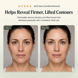 RF Facial Photon LED Skin Care Beauty Device for Home